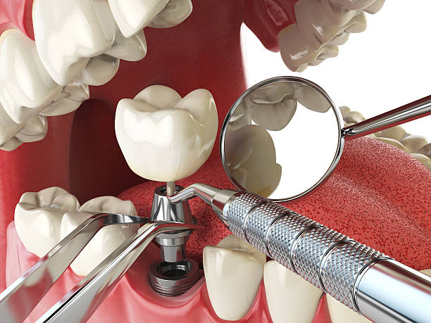 Best After-Hours Emergency Dentist in Coats Bend, AL